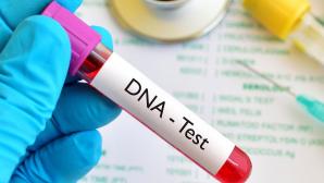 DNA test kit